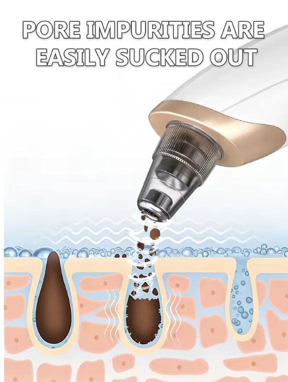 Premium Blackhead Remover Vacuum – Deep Pore Cleaner with 4 Suction Heads 2026